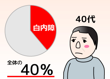 日帰り白内障手術 加齢性白内障は40代では全体の約40％ 富山で白内障日帰り手術 岡本眼科
